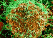 Sebanyak 2.378 Orang Tewas, Wabah Ebola RD Kongo Jadi yang Terburuk