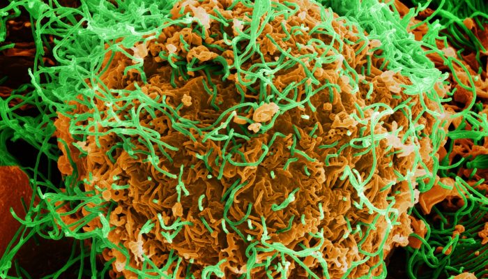 Sebanyak 2.378 Orang Tewas, Wabah Ebola RD Kongo Jadi yang Terburuk