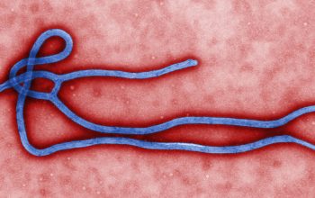 5.794 Kasus Ebola Tercatat di Kongo, WHO Pertahankan Status Darurat Internasional