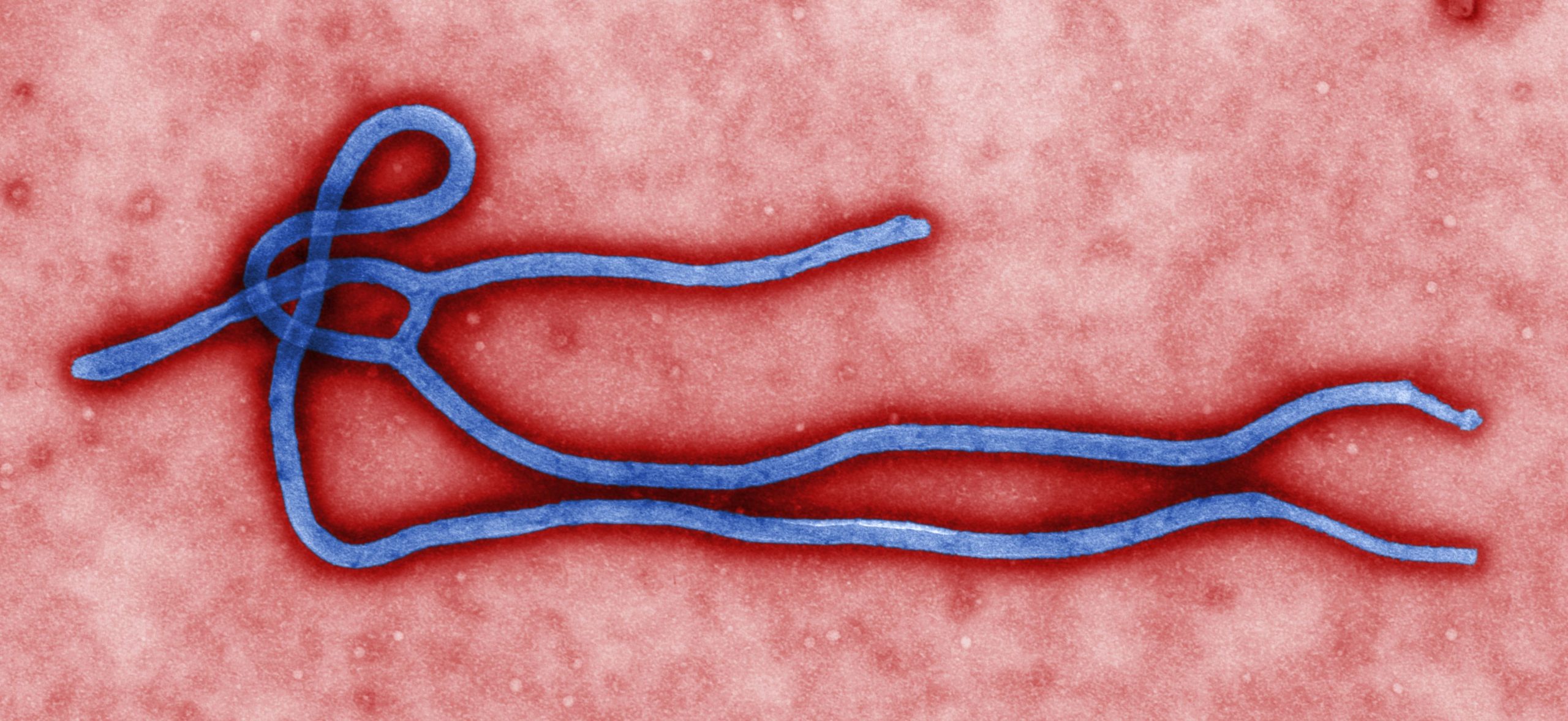 5.794 Kasus Ebola Tercatat di Kongo, WHO Pertahankan Status Darurat Internasional
